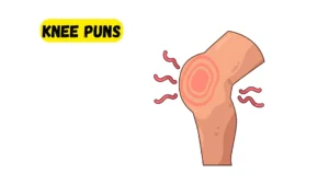 Read more about the article 623 Clever Knee Puns 2025