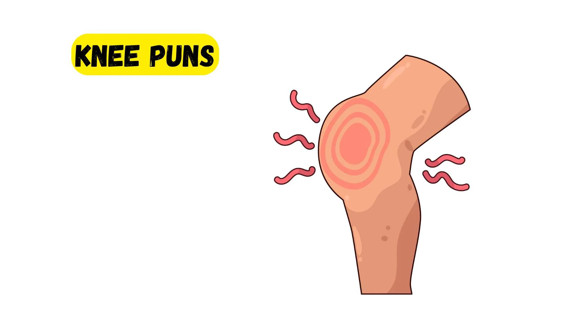 You are currently viewing 623 Clever Knee Puns 2025